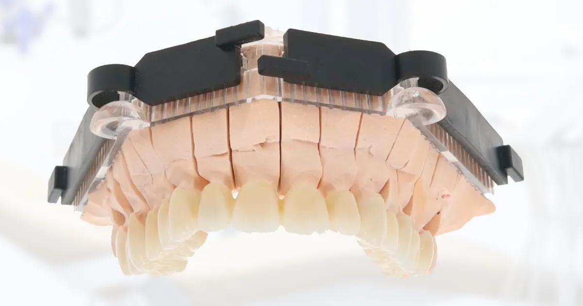 Coroanele dentare din zirconiu – tipuri și beneficii